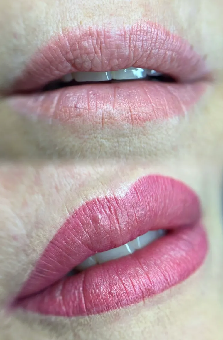 Después de la micropigmentación de labios